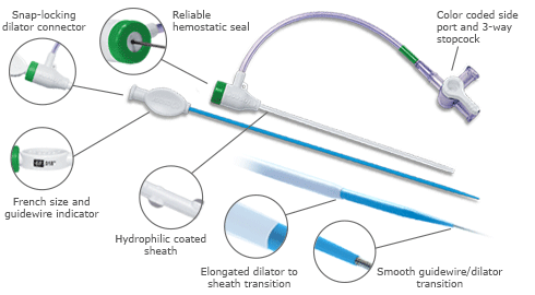 The Adelante Radial introducer with hemostasic valve showing, snap locking dilator connector, reliable hemostatic seal, color coded side port and three way stopcock, hydrophilic coated sheath, smooth guidewire dilator transition, elongated dilator to sheath transition, kink resistant, flexible, coated, hemostasic valve facilitates easy insertion with reliable seal function to minimize blood leakage, French size and guidewire indicator 