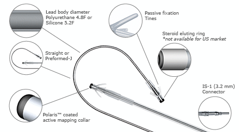 The RZ permanent pacing lead - showing Lead body diameter Polyurethane 4.8F or Silicone 5.2F, Passive fixation tines, Steroid eluting ring not available for US market, Straight or preformed J, IS 1 (3.2mm) connector, Polaris coated active mapping collar